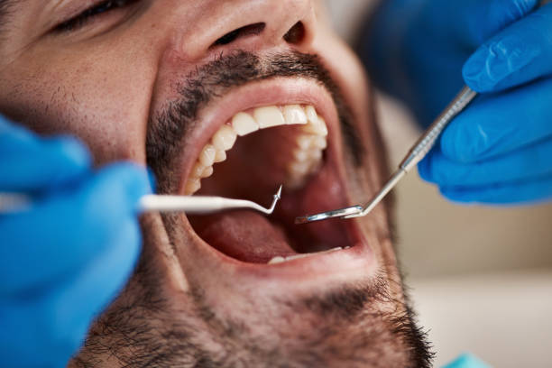 Best Emergency Treatment for Toothache in Griswold, IA